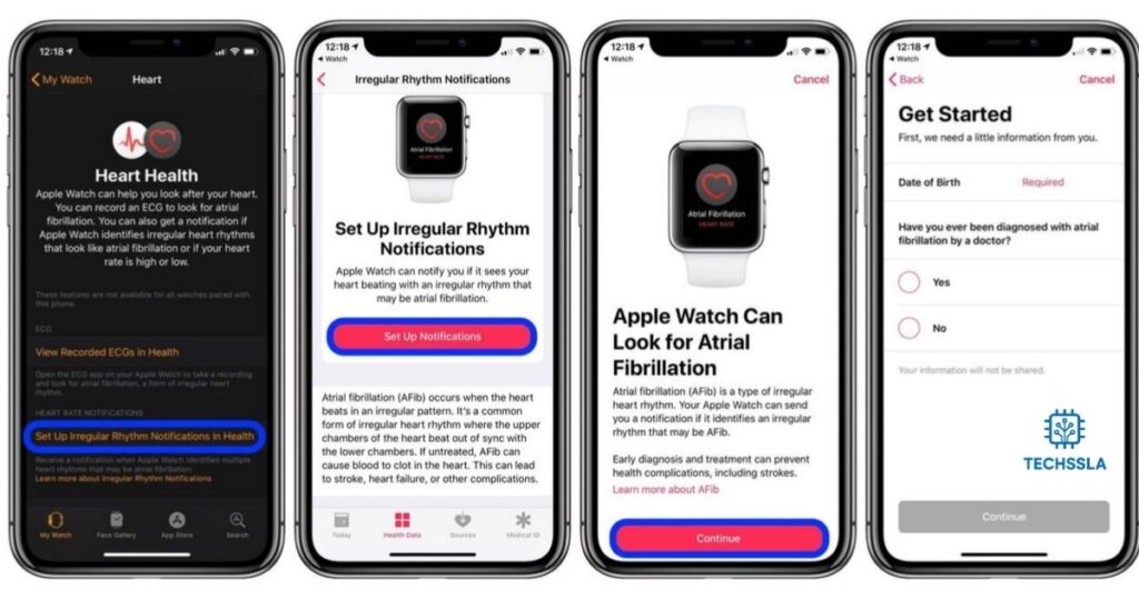 How to Enable Hypertension Notifications on Apple Watch
